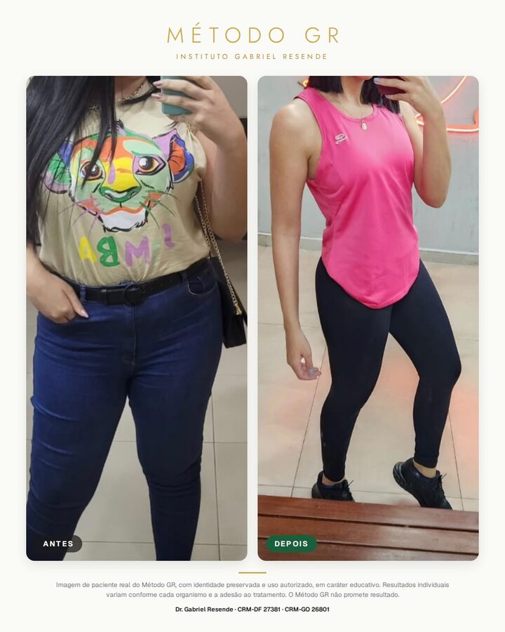 Resultado de paciente do Método GR, identidade preservada, resultado 2