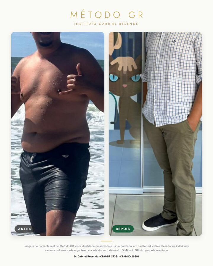 Resultado de paciente do Método GR, identidade preservada, resultado 7