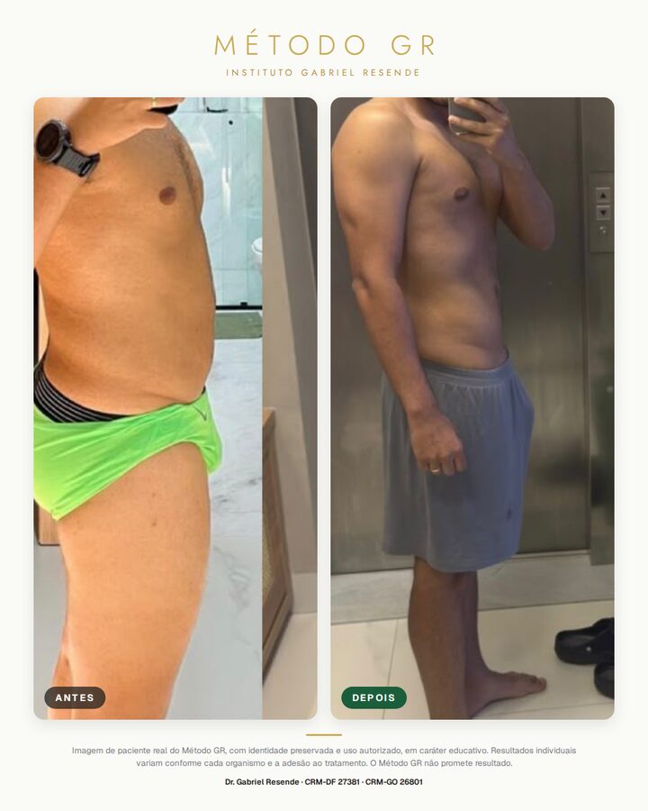 Resultado de paciente do Método GR, identidade preservada, resultado 10