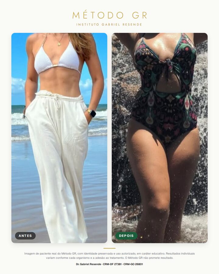Resultado de paciente do Método GR, identidade preservada, resultado 13